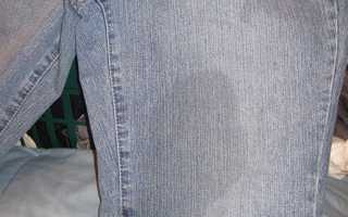 Как с джинсовой ткани вывести жирное пятно от растительного или машинного масла в домашних условиях