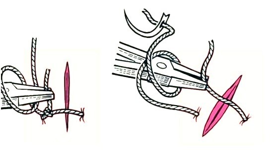 Устранение пореза на ткани